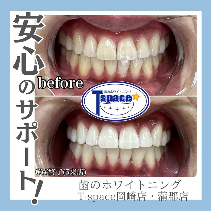 画像437
