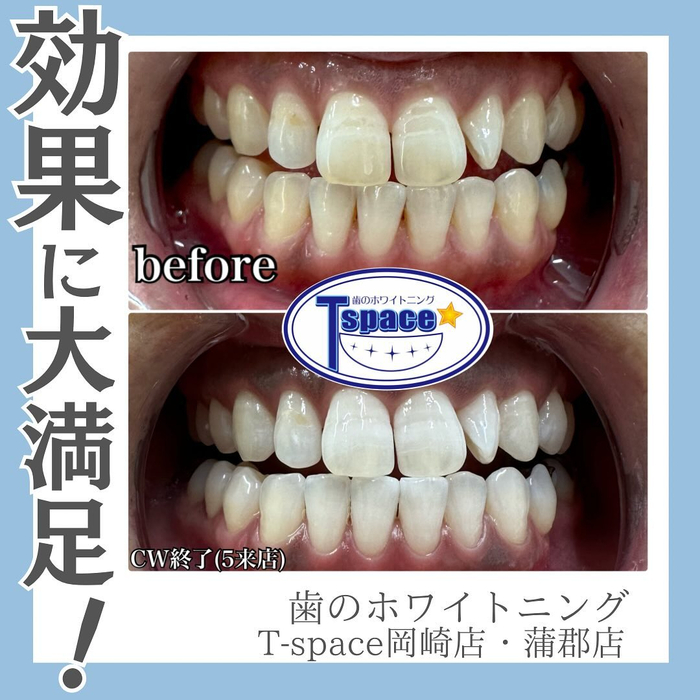 画像462