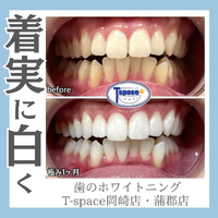 画像476