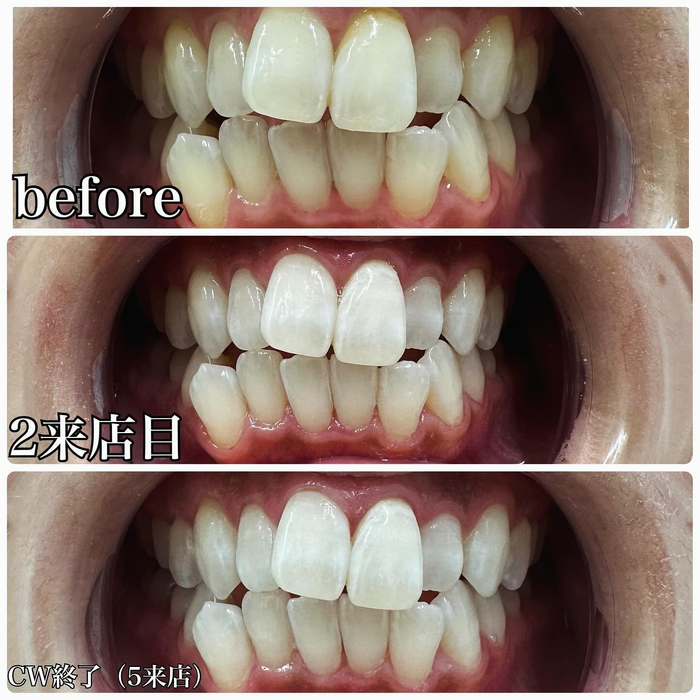 画像523