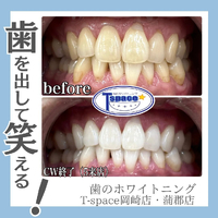 画像741