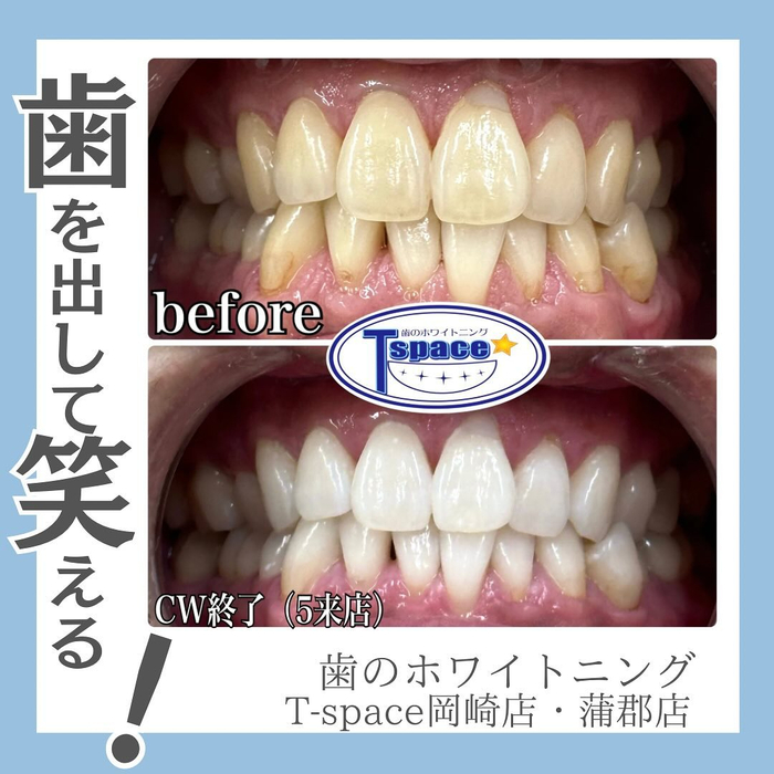 画像741