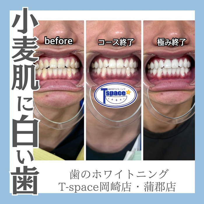 画像791